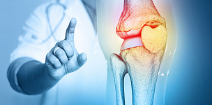 Принципы лечения остеоартроза у коморбидных пациентов